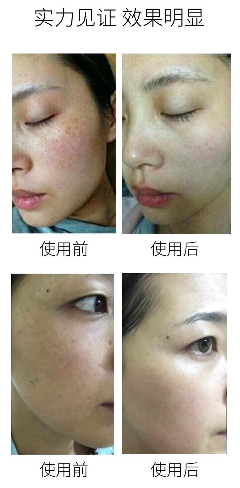 美白保湿套装(图20)